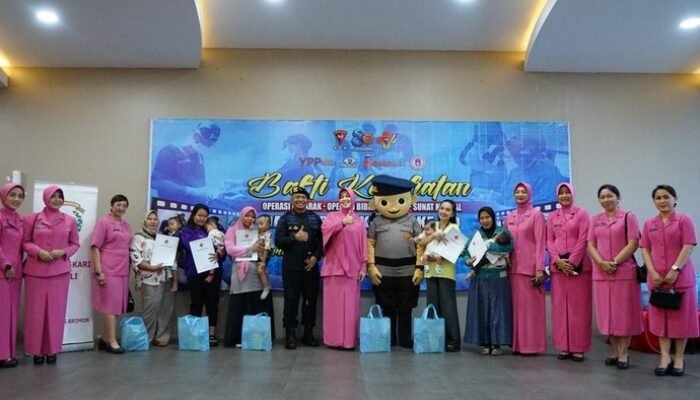 **Korps Brimob Beri Operasi Bibir Sumbing Gratis, Peringati HUT ke-80 dengan Bakti Sosial Luas**