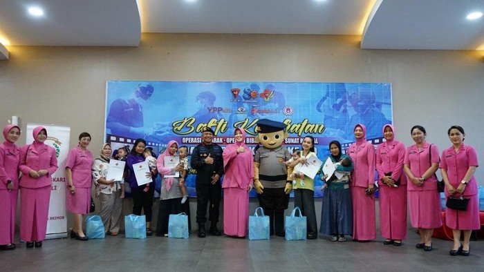 **Korps Brimob Beri Operasi Bibir Sumbing Gratis, Peringati HUT ke-80 dengan Bakti Sosial Luas**